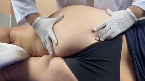 La falsa sciatica is a pain similar to sciatica