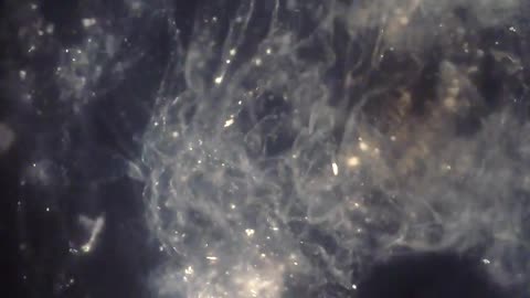 SHARDS OF GLASS ANF FUNGI AND OTHER POISONS IN THE WATER