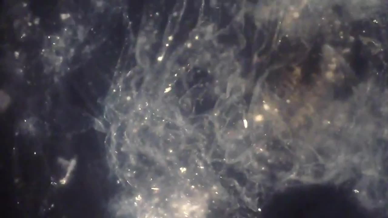 SHARDS OF GLASS ANF FUNGI AND OTHER POISONS IN THE WATER