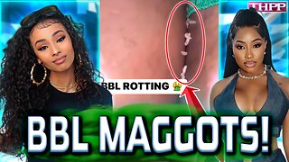 STRUGGLE Rappers' BBLs are ROTTING with MAGGOTS!? Corey Holcomb WARNED Y'all!