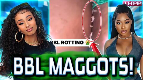 STRUGGLE Rappers' BBLs are ROTTING with MAGGOTS!? Corey Holcomb WARNED Y'all!