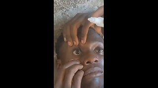 Eye Drops | Green Screen