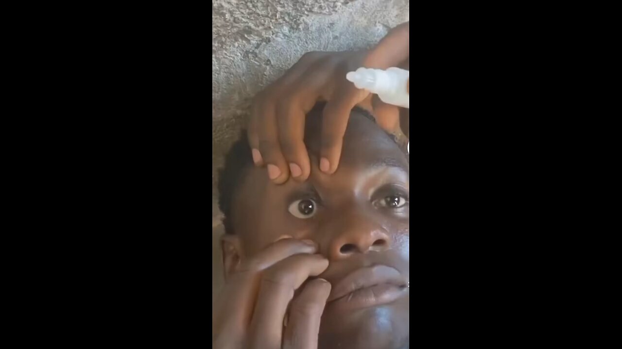 Eye Drops | Green Screen