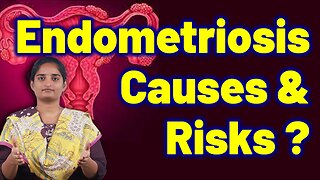 Causes Of Endometriosis Hormonal Pelvic disorder | Treatment Cure Medicine Surgery Gynaecology Women