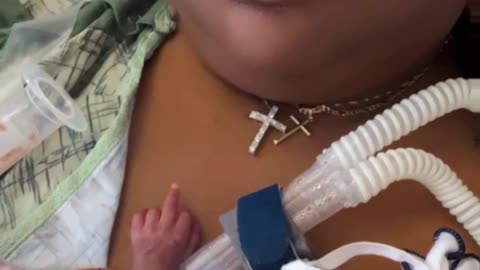 Baby Is Over the NICU