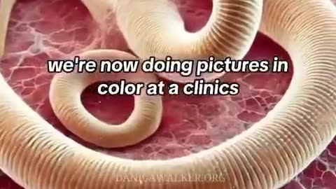 Parasites