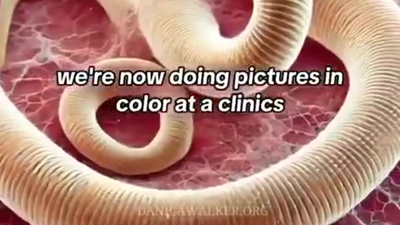 Parasites