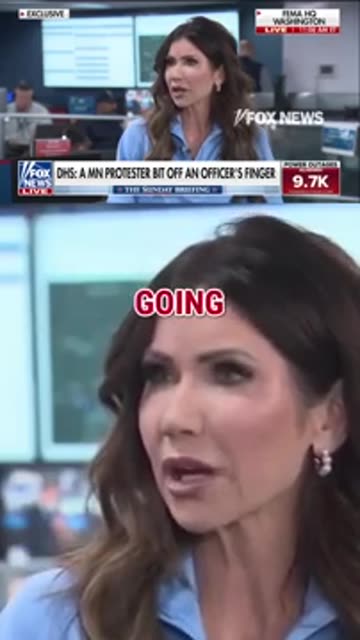 ICE agent finger gets bitten off