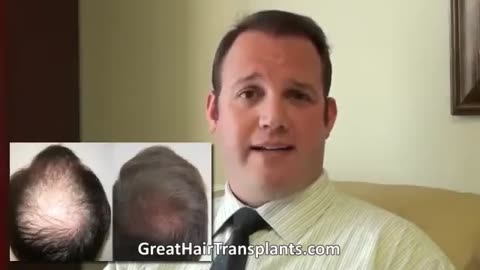 Dr. Brett Bolton Shares Hair Transplant Expertise