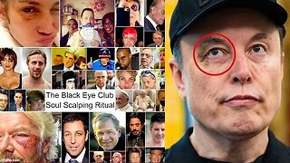 Elon Musk Black Eye - You Don't Talk About Fight Club - Room 101 - SMHP