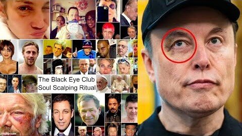 Elon Musk Black Eye - You Don't Talk About Fight Club - Room 101 - SMHP