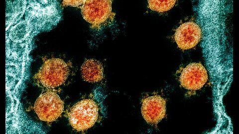 129 | Dr. Max Foundation: I nuovi vaccini a sa RNA e vaccinazioni precedenti, 10/9/25