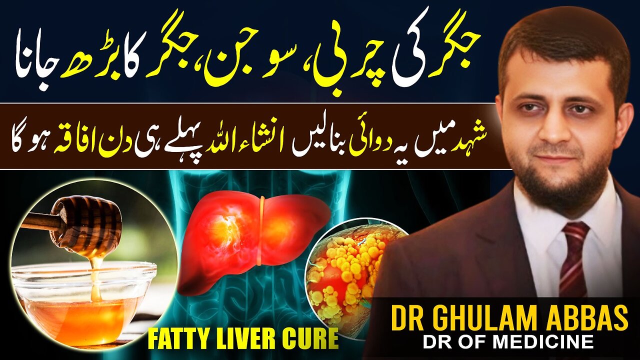 "Fatty Liver Explained: Causes, Symptoms & Treatment | Dr. Ghulam Abbas's Expert Advice"