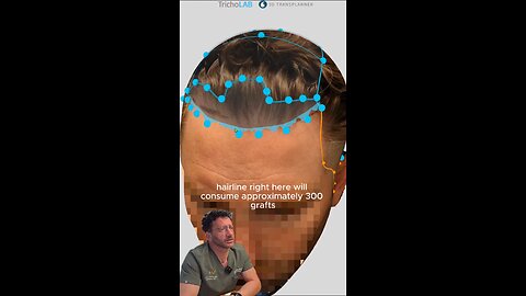 Rebuilding a Natural-look!