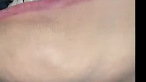 Must Watch: No other cosmetic appliance does this ! Snap-on Smile ❤️
