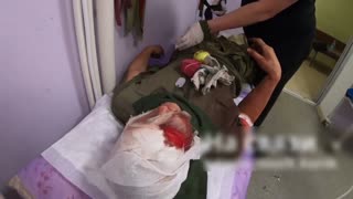 Wounded Russian Soldier Holding On to Apple While Being Examined