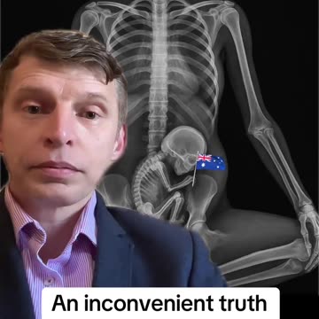 A hard truth that Aussies need to hear