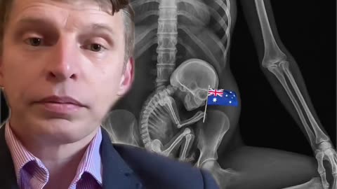 A hard truth that Aussies need to hear