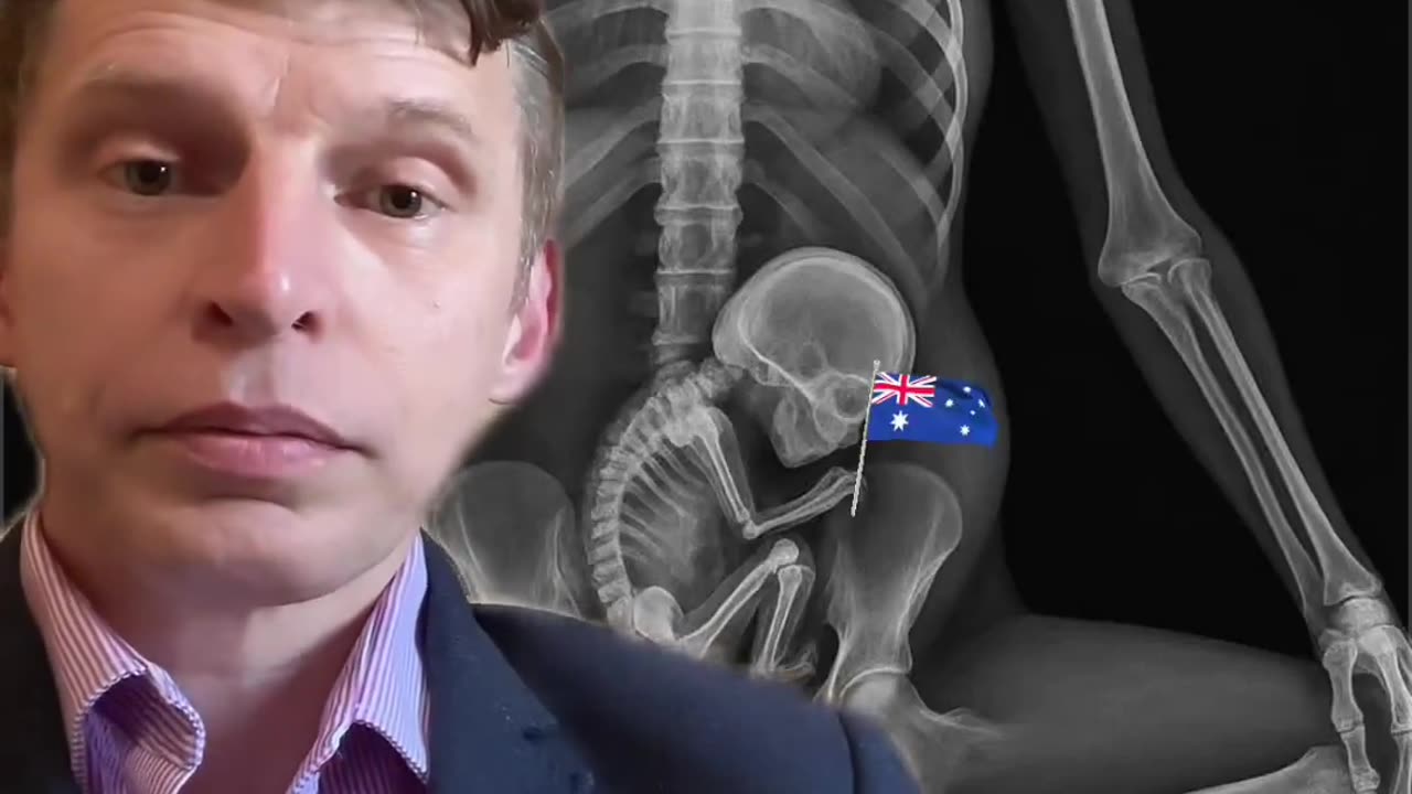 A hard truth that Aussies need to hear