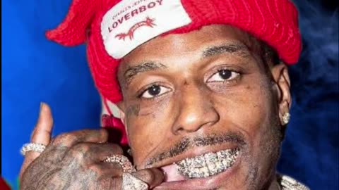 🎯 Sauce Walka Happy To See the Bullet Fragment Come out his Leg