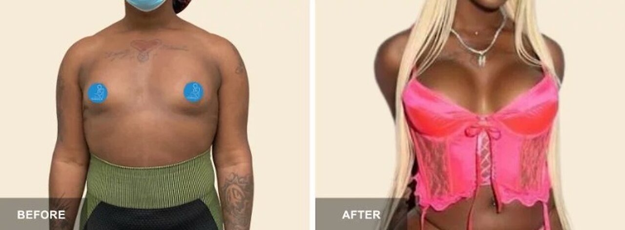 ‘Boob Jobs’ Dem Utters Possibly the Most Unhinged, Absurd ‘Trans’ Take Ever