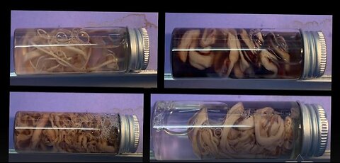 👀👀👀🌟💣🌟The Nefarious Science Behind the Clot Shots- by Greg Reece👀👀👀🌟💣🌟