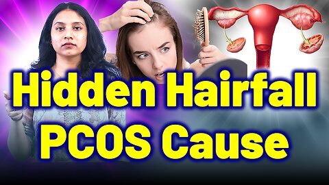 Struggling With Hair Fall, Androgenic Alopecia? Check for PCOS. | Treatment & Cure| Homeopathy