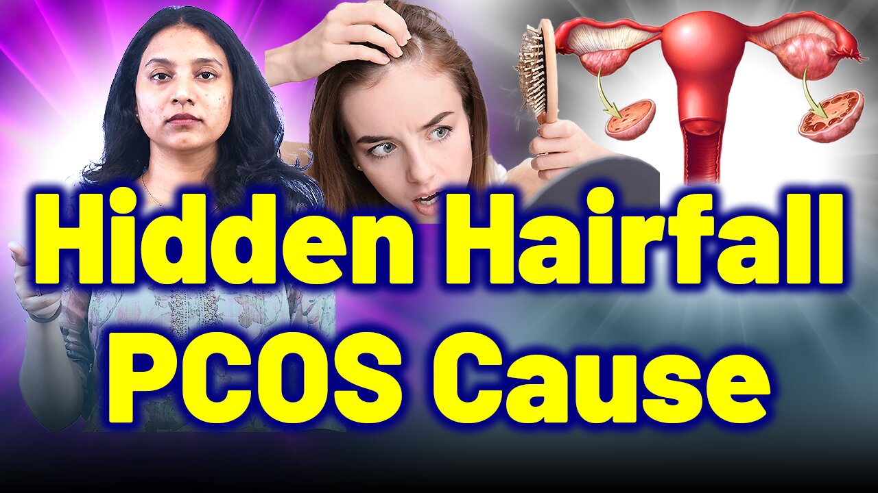 Struggling With Hair Fall, Androgenic Alopecia? Check for PCOS. | Treatment & Cure| Homeopathy