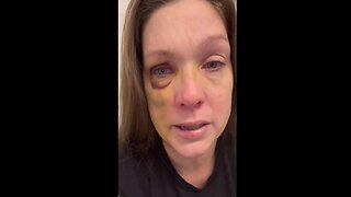 WHITE MOM Who Was Brutally Beaten in Cinci IS SO APPRECIATIVE - $160,000 has been raised for her 🙏