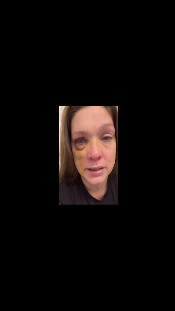 WHITE MOM Who Was Brutally Beaten in Cinci IS SO APPRECIATIVE - $160,000 has been raised for her 🙏