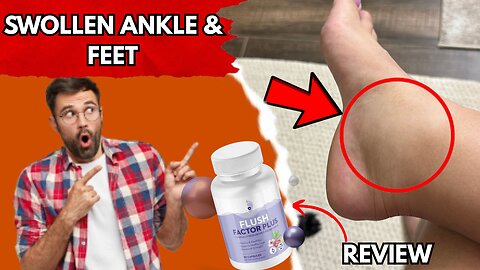Why Your Legs Stay Swollen – And How Flush Factor Plus Can Help