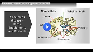 Alzheimers disease - herbs, supplements & nutrients