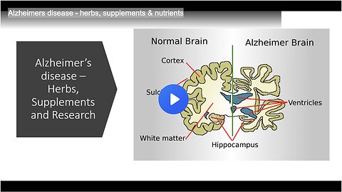 Alzheimers disease - herbs, supplements & nutrients