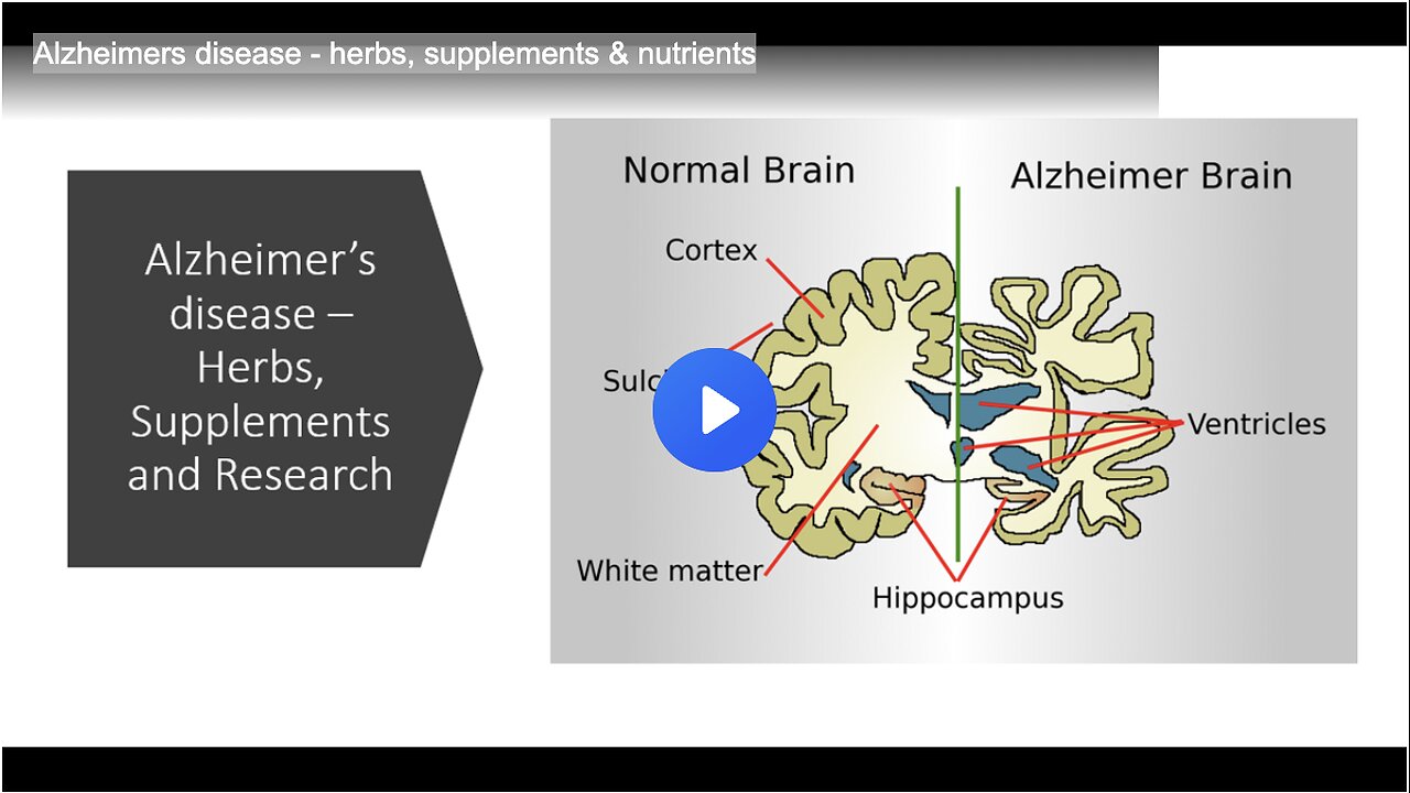 Alzheimers disease - herbs, supplements & nutrients