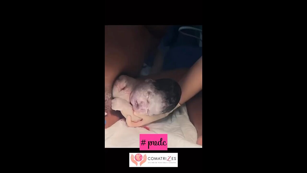 Watch Live. The process of delivery of a Baby.