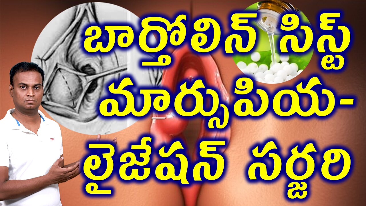 బార్తోలిన్ సిస్ట్ మార్సుపియలైజేషన్ సర్జరిBartholin Cyst Marsupialization Sugery Drawbacks Homeopathy