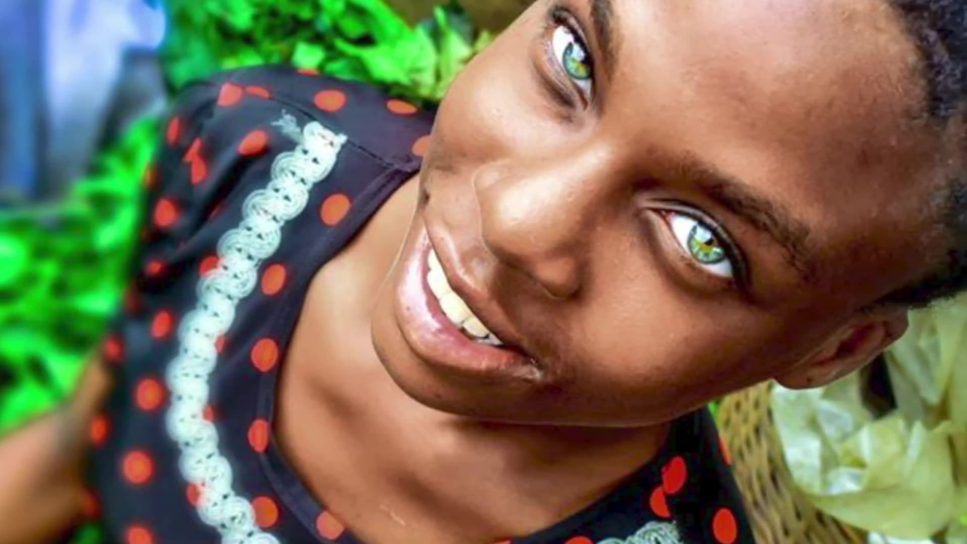 ๐ Africans with Blue Eyes โ The Rarest Eye Colors in Africa! ๐โจ