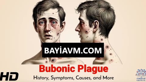 Plague Hangi Hastalıktır?