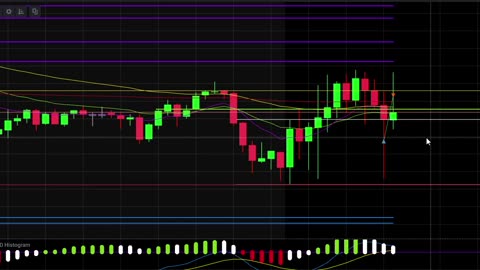 Day Trading; NQ (Nasdaq 100). #trading #daytrading #nasdaq100 #mcctrading