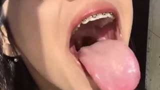 Asian cute Braces Girl Pulling Tongue