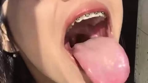 Asian cute Braces Girl Pulling Tongue