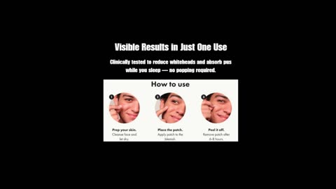 YOUR ACNE SOLUTION IS HERE