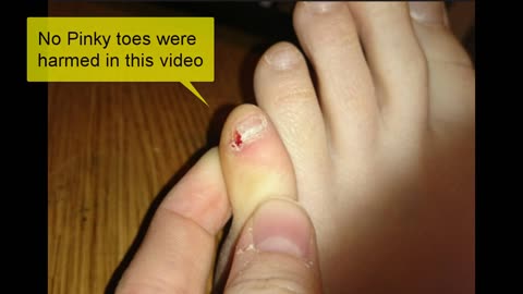 The Secret of My Patented Pinky Toe Takedown