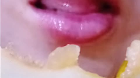Tongue action
