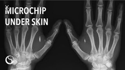 RFID MICROCHIP UNDER YOUR SKIN.(MOTB)…”to receive a mark in their right hand, or in their foreheads” 🕎Luke 20:25 “Render therefore unto Caesar the things which be Caesar's”