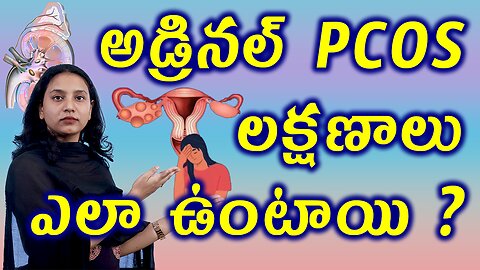 అడ్రినల్ PCOS లక్షణాలు ఎలా ఉంటాయి? Signs and Symptoms of Adrenaline PCOS Best Homeopathy Tretament