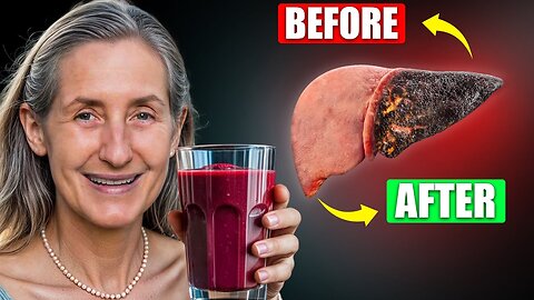This Liver Detox Juice Recipe Will CLEANSE Your Liver FAST! (Best Recipe!)