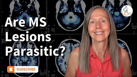 Are MS Lesions Parasitic? | Pam Bartha