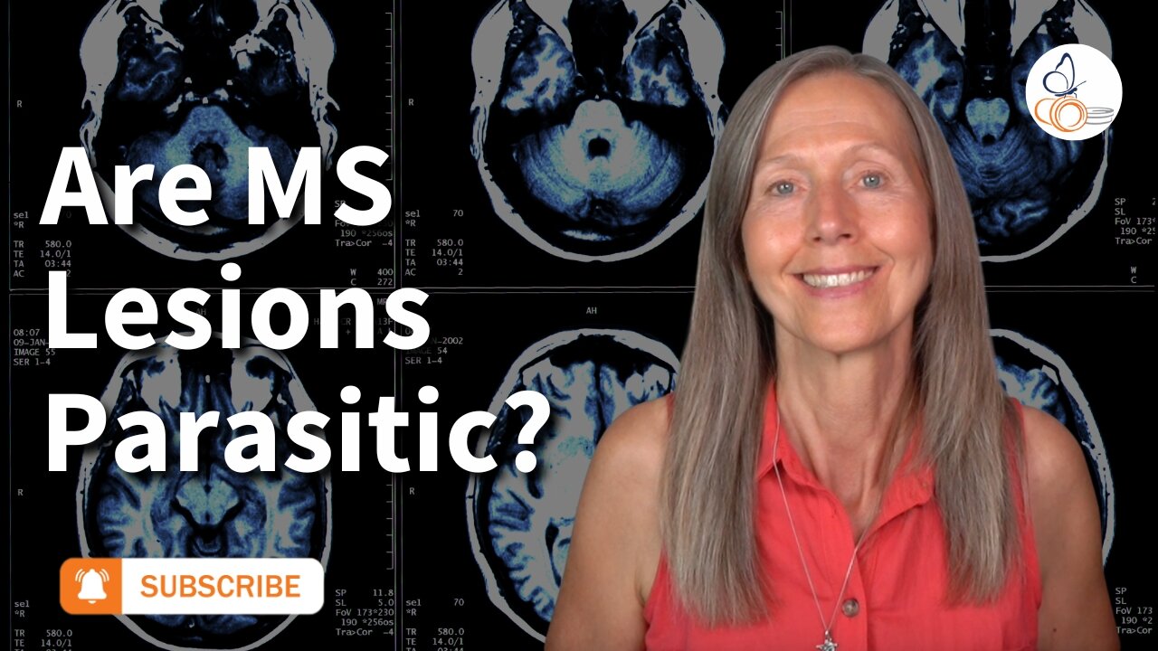 Are MS Lesions Parasitic? | Pam Bartha