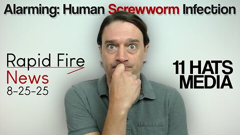 Alarming: Human Screwworm Infection | Rapid Fire News 8-25-25